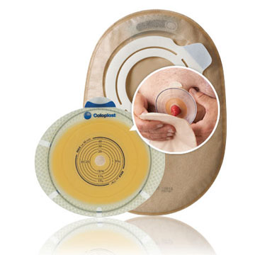 Stoma-Versorgung Stoma-Versorgung